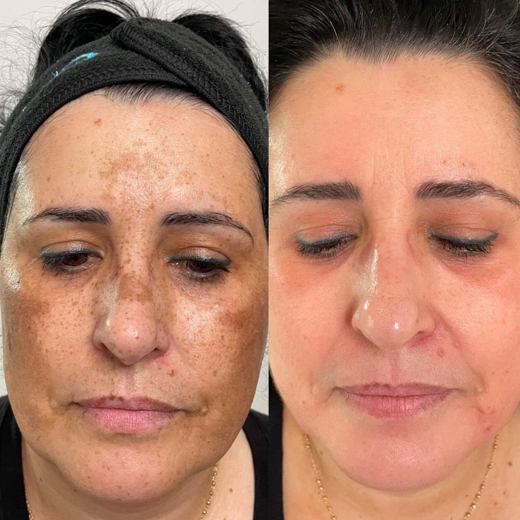 Crema Facial Iluminadora SEORA CON Arbutina 7% + Ácido Tranexámico 4% 50ML –