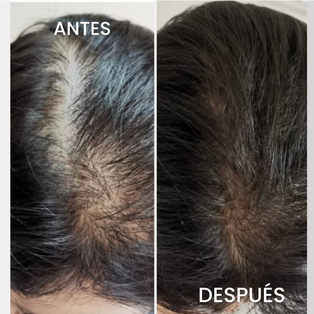 Batana Pack (Aceite de batana + Champù de batana)