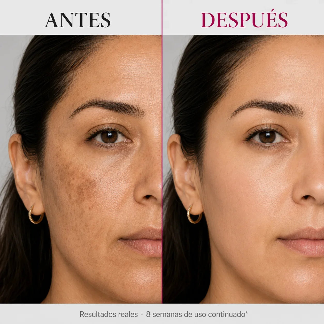 Crema Facial Iluminadora SEORA CON Arbutina 7% + Ácido Tranexámico 4% 50ML –