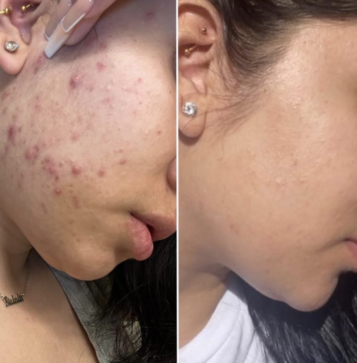 Crema Facial Iluminadora SEORA CON Arbutina 7% + Ácido Tranexámico 4% 50ML –