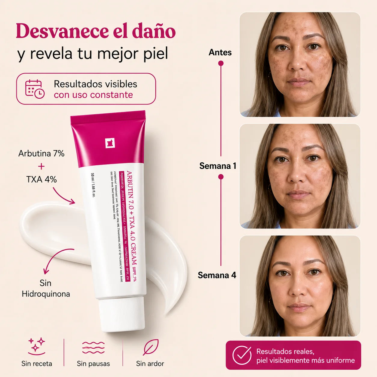 Crema Facial Iluminadora SEORA CON Arbutina 7% + Ácido Tranexámico 4% 50ML –